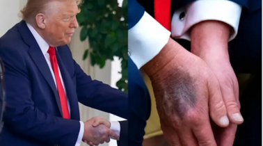 What is the Health Condition of Donald Trump?