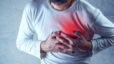 Arterial plaque is one of the causes of heart attacks
