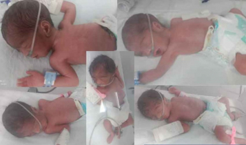 Pakistani Couple Welcomes Quintuplets