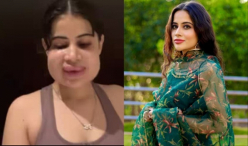 Uorfi Javed opens up about cosmetic reversal