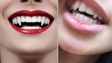 New trend vampire teeth, why young women are increasingly interes