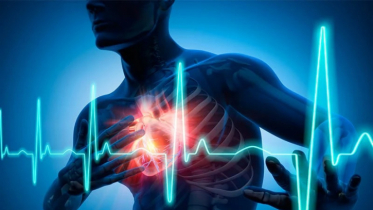 Heart attack and cardiac arrest are not the same, doctor’s advice Heart attack and cardiac arrest are not the same, doctor’s advice