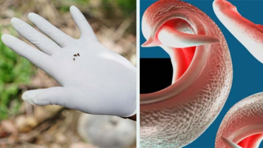 Scientists warn that a parasite that affects the genitals