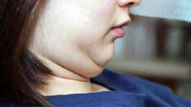 Are your cheeks swollen? Be careful now