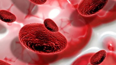 Symptoms of aplastic anemia that should be alerted when seen