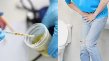 6 Symptoms of Urination: Silent Cancer Warning Signs